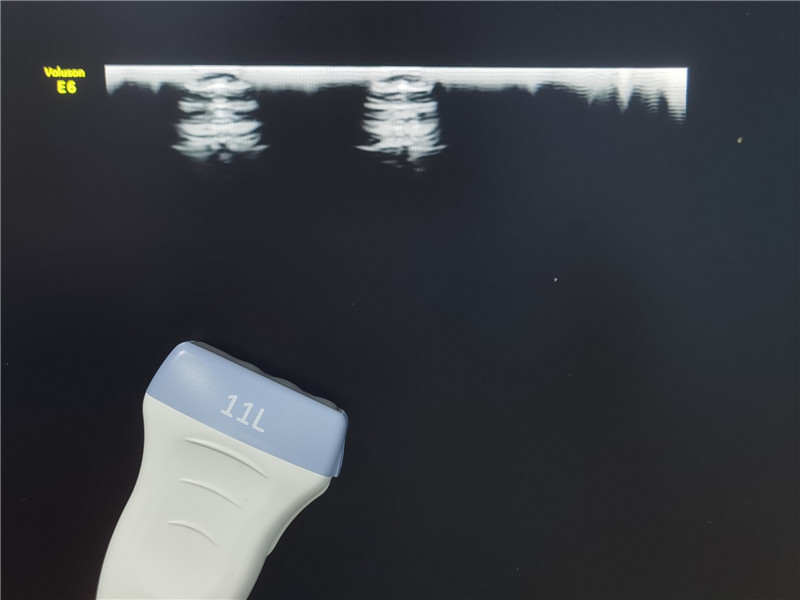 Picture effect after the repair (2)