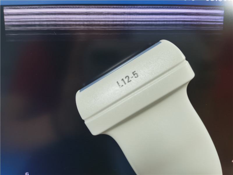 Picture effect after the repair (2)