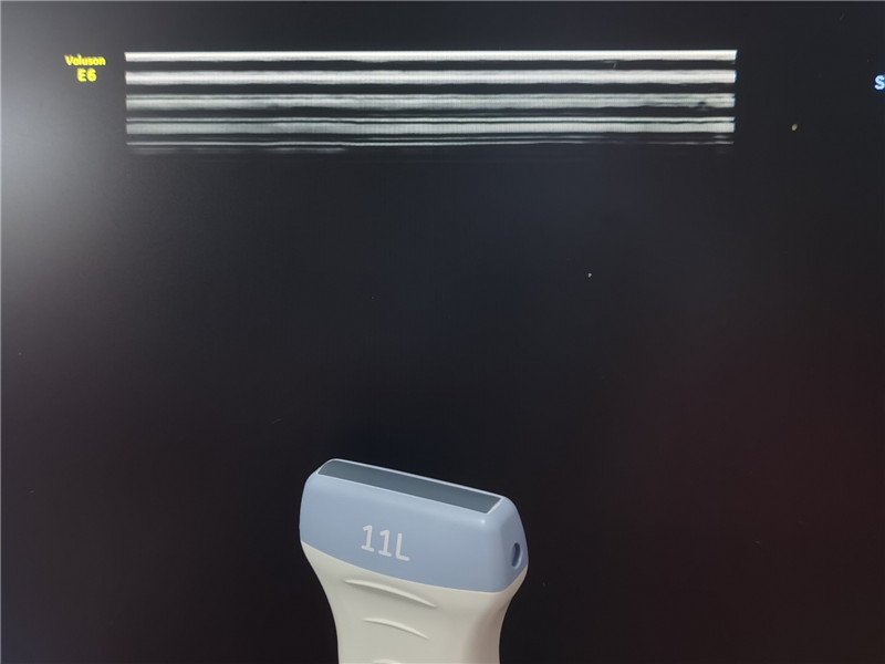 Picture effect after the repair (1)